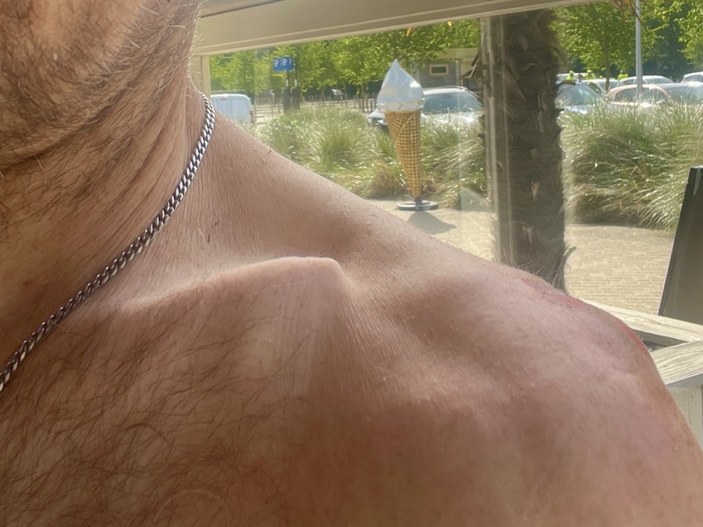 Geen röntgenfoto voor nodig